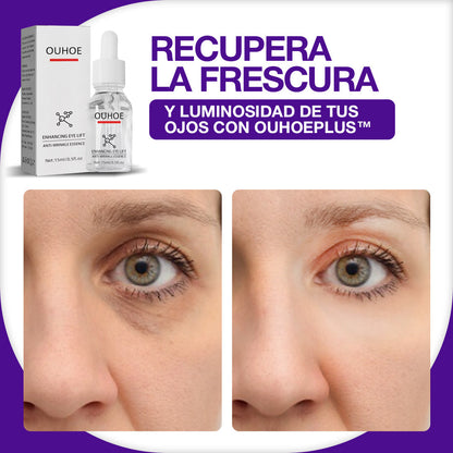 1+1 GRATIS OUHOEPLUS™ ACABA CON LAS OJERAS EN 5 DIAS | TU MIRADA TE LO AGRADECERA